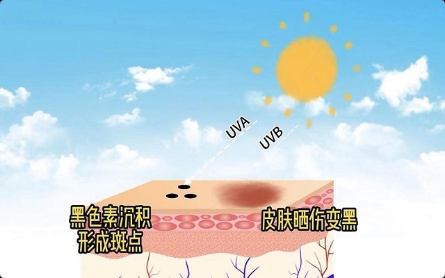 天然南宫电子官网能够祛斑吗？